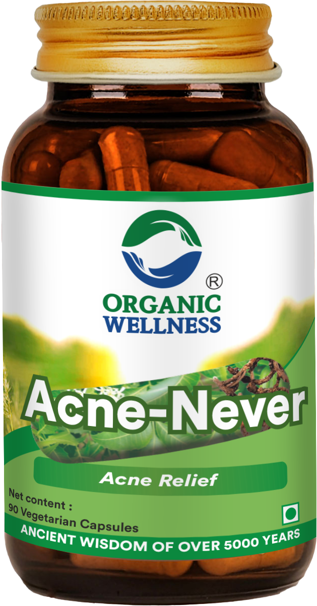 Acne Never 90 Capsules